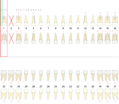 10.2024 EDR - peridontal chart