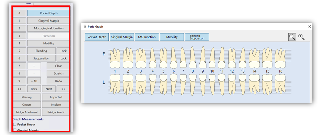 nextgen-edr-new-buttons-new-display-periodontal-charting-osis